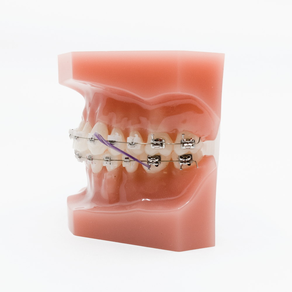 50 Packs Dental Clear 1/4 5.0 Oz Orthodontic Latex Elastic Braces