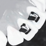 Bite Turbos (10/Pack)