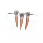 .016 x .022 Upper Titanol Super Elastic Shape 2 (10/Pack)