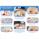 GluStitch® Twist Tissue Adhesive, Sterile, 12 x 0.5 mL