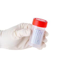 Sputum Container