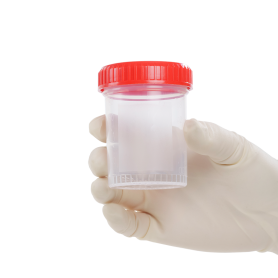 Specimen Containers